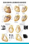 冠状动脉和心的静脉及动脉造影