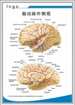 脑动脉外侧观解剖图