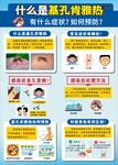 基孔肯雅熱防治知識