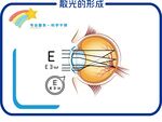 散光的形成