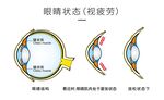 眼球結(jié)構(gòu)圖