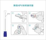 男性HPV取样