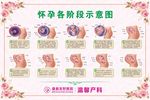 产科展板