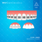 牙齿矫正
