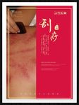 刮痧