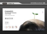 脱发