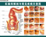 腊肠科解剖与常见疾病示意图