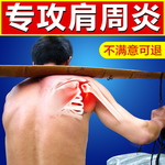 肩周炎