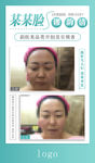 对比图海报