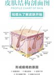 皮肤结构剖面图 祛痘 痤疮形成