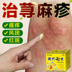 荨麻疹