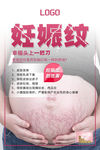 妊娠纹海报