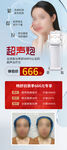 医美展架活动图