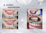 牙齿矫正前后对比展示