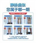 静脉曲张分期图