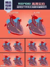 心房颤动心房扑动演示动画