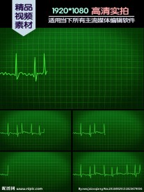 心电图异常动画演示