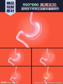 Vsg手术垂直袖状胃切除术