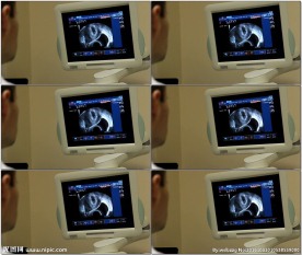 人工授精医疗监视屏