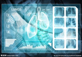 肺脏X光医疗信息背景图