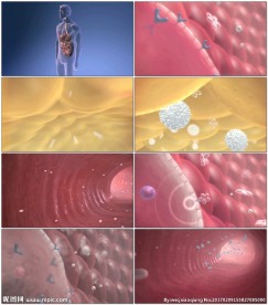 糖尿病医疗演示动画