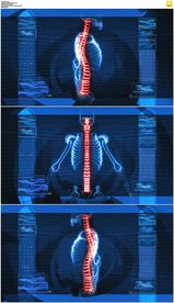 转动的脊椎骨骼