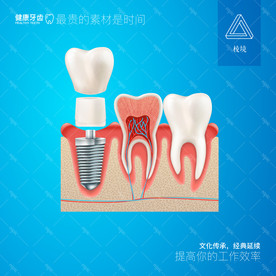 牙齿种植