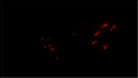 AE动态燃烧火焰模板