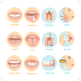 口腔护理的前十二期