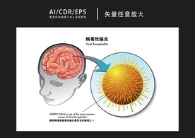 矢量医学病毒性脑炎图解插画