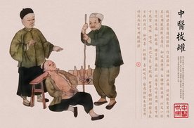 中医拔罐