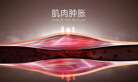 运动肌肉肿胀拉伤医疗海报
