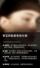 色斑分类