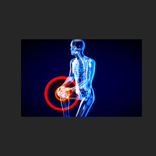 关节活动骨骼健康动画