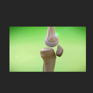 关节活动骨骼健康动画