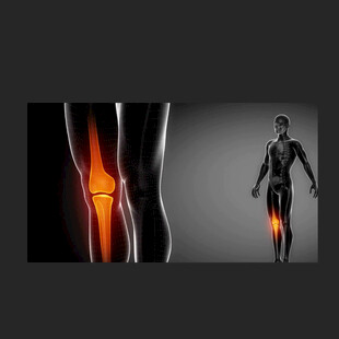 关节活动骨骼健康动画