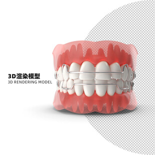 口腔矫正3D渲染模型