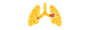 人体肺部解剖结构示意图