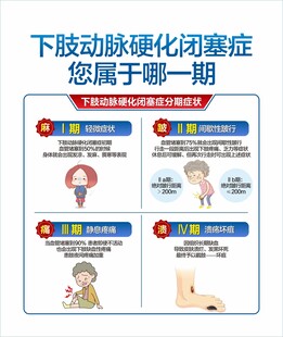 动脉硬化闭塞症