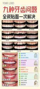 口腔科普牙贴面的九种情况海报