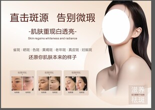 美业祛斑灯箱广告