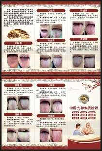 中医体质辨识三折页